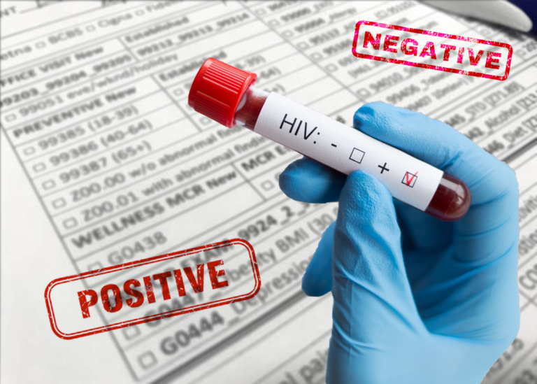 HIV Tests Recalled From Montreal Hospitals The McGill Daily   Hivfalsetests 768x549 